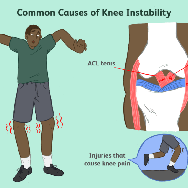 Unilateral Osteoarthritis and treatment with orthosis