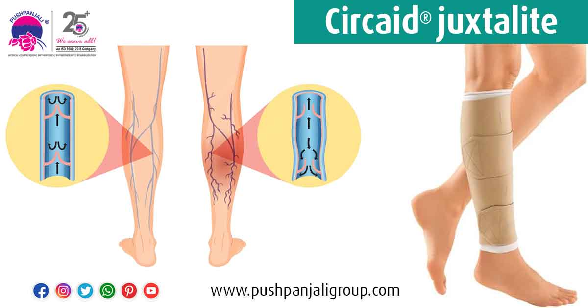 The perils of mild to severe lymphoedema and effective treatment with inelastic compression garments!